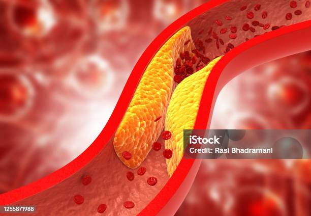 Cholesterol
